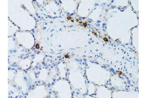 Immunohistochemistry of paraffin-embedded rat lung using TEFM antibody (ABIN5974873) at dilution of 1/100 (40x lens). (TEFM 抗体)