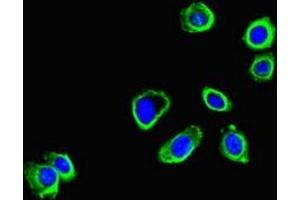 Immunofluorescence (IF) image for anti-Coronin, Actin Binding Protein, 1B (CORO1B) (AA 252-453) antibody (ABIN7148597)