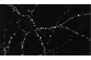 Immunocytochemistry/Immunofluorescence analysis using Mouse Anti-PSD95 Monoclonal Antibody, Clone 6G6 . (DLG4 抗体  (PE))