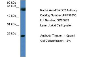 WB Suggested Anti-FBXO32  Antibody Titration: 0. (FBXO32 抗体  (N-Term))