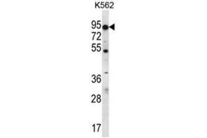 Western Blotting (WB) image for anti-ATP-Binding Cassette, Sub-Family D (ALD), Member 2 (Abcd2) (AA 552-582), (C-Term) antibody (ABIN950203)