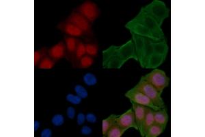 ABIN6258775 and ABIN6274251 staining Hela cells(24h of starvation treatment) by IF/ICC. (ETV6 抗体  (Internal Region))