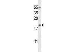 DROSHA antibody western blot analysis in NCI-H460 lysate (DROSHA 抗体  (AA 124-151))