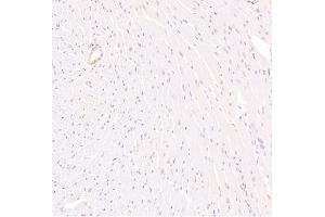 Immunohistochemistry (Paraffin-embedded Sections) (IHC (p)) image for anti-Zinc Finger Protein, FOG Family Member 2 (ZFPM2) antibody (ABIN7076277)