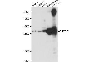 Western blot analysis of extracts of various cell lines,ing CRYBB2 antibody (ABIN5969861) at 1/1000 dilution. (CRYbB2 抗体)