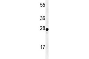 Western blot analysis of AANAT antibody and human Y79 lysate. (AANAT 抗体  (AA 27-54))