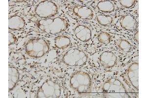 Immunoperoxidase of monoclonal antibody to MTSS1 on formalin-fixed paraffin-embedded human colon. (MTSS1 抗体  (AA 346-445))