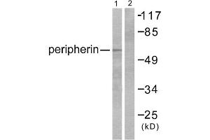 Western blot analysis of extracts from HepG2 cells, using Peripherin antibody (ABIN5976490). (Peripherin 抗体  (C-Term))