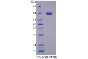 SDS-PAGE analysis of Rat GTF3A Protein. (GTF3A 蛋白)