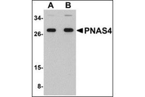 Western blot analysis of PNAS4 in EL4 cell lysate with this product at (A) 1 and (B) 2 μg/ml.