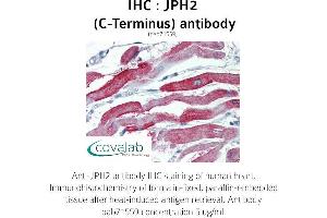 Image no. 1 for anti-Junctophilin 2 (JPH2) (C-Term) antibody (ABIN1736131) (Junctophilin 2 抗体  (C-Term))