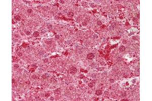 Anti-MST1 antibody IHC of human liver. (MST1 抗体  (AA 540-589))