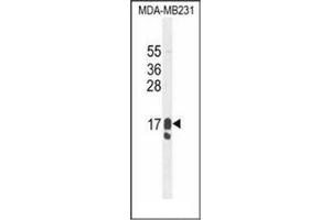 Western blot analysis of PIP / GCDFP15 Antibody (C-term) in MDA-MB231 cell line lysates (35ug/lane). (PIP 抗体  (C-Term))