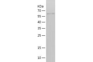 Western Blotting (WB) image for Glioma Tumor Suppressor Candidate Region Gene 2 (GLTSCR2) (AA 141-478) protein (His-IF2DI Tag) (ABIN7123096) (GLTSCR2 Protein (AA 141-478) (His-IF2DI Tag))