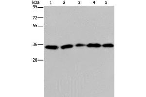 Western Blot analysis of Hela cell, Jurkat cell and Human placenta tissue, Human testis tissue and 231 cell using OCIAD1 Polyclonal Antibody at dilution of 1:200 (OCIAD1 抗体)