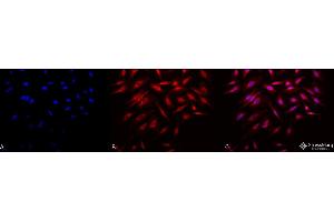Immunocytochemistry/Immunofluorescence analysis using Rabbit Anti-Rab4 Polyclonal Antibody . (Rab4 抗体  (C-Term) (Atto 390))