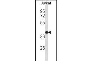 Western blot analysis in Jurkat cell line lysates (35ug/lane). (SET/TAF-I 抗体  (N-Term))