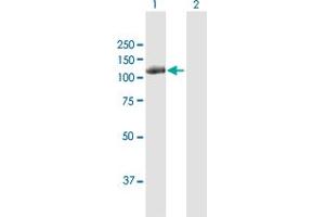 Western Blot analysis of CBL expression in transfected 293T cell line by CBL MaxPab polyclonal antibody. (CBL 抗体  (AA 1-906))