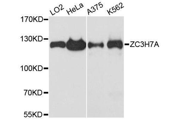 ZC3H7A 抗体  (AA 1-220)