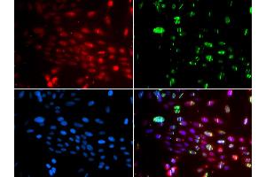 Immunofluorescence analysis of GFP-RNF168 transgenic U2OS cells using L3MBTL1 antibody (ABIN5974264). (L3MBTL1 抗体)