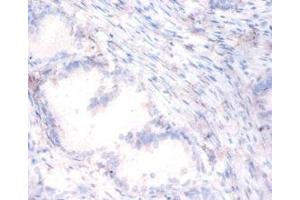 Immunohistochemistry of paraffin-embedded human prostate tissue using ABIN7169381 at dilution of 1:100 (PON1 抗体  (AA 2-355))