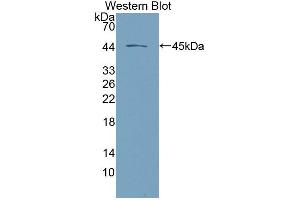 Western blot analysis of the recombinant protein. (Desmoglein 2 抗体  (AA 275-533))