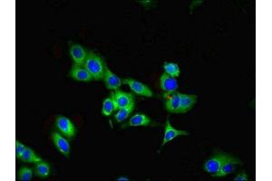 Immunofluorescent analysis of Hela cells using ABIN7166460 at dilution of 1:100 and Alexa Fluor 488-congugated AffiniPure Goat Anti-Rabbit IgG(H+L) (PARK7/DJ1 抗体  (AA 1-188))