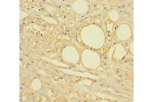 Immunohistochemistry of paraffin-embedded human skin tissue using ABIN7142622 at dilution of 1:100 (HTR2A 抗体  (AA 385-471))