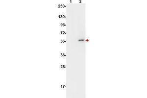 Western Blotting (WB) image for anti-V-Akt Murine Thymoma Viral Oncogene Homolog 1 (AKT1) (pSer473) antibody (ABIN349614)
