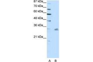 Western Blotting (WB) image for anti-Pituitary Homeobox 3 (PITX3) antibody (ABIN2461738) (PITX3 抗体)