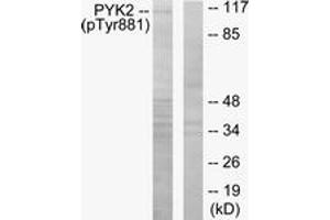 Western blot analysis of extracts from mouse brain, using PYK2 (Phospho-Tyr881) Antibody. (PTK2B 抗体  (pTyr881))