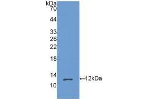 Detection of Recombinant OSM, Mouse using Polyclonal Antibody to Oncostatin M (OSM) (Oncostatin M 抗体  (AA 25-115))