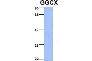 Host:  Rabbit  Target Name:  GGCX  Sample Type:  Jurkat  Antibody Dilution:  1. (GGCX 抗体  (Middle Region))