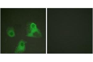 Immunofluorescence analysis of HeLa cells, using ADD1 (Phospho-Ser726) Antibody. (alpha Adducin 抗体  (pSer726))