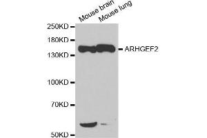 Western blot analysis of extracts of various cell lines, using ARHGEF2 antibody. (ARHGEF2 抗体)