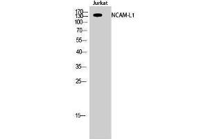 Western Blotting (WB) image for anti-L1 Cell Adhesion Molecule (L1CAM) (Ser727) antibody (ABIN3185776) (L1CAM 抗体  (Ser727))