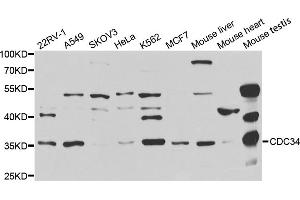 Western blot analysis of extracts of various cell lines, using CDC34 antibody. (CDC34 抗体)