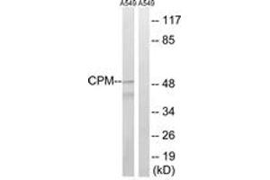 Western blot analysis of extracts from A549 cells, using CPM Antibody. (CPM 抗体  (AA 71-120))