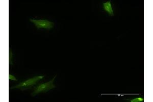 Immunofluorescence of monoclonal antibody to CAMKK1 on HeLa cell. (CAMKK1 抗体  (AA 2-100))