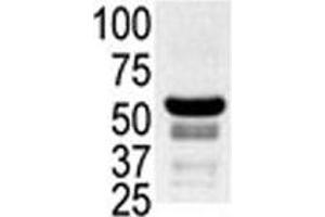 Western blot testing of ovary lysate with PAK2 antibody. (PAK2 抗体  (AA 192-222))