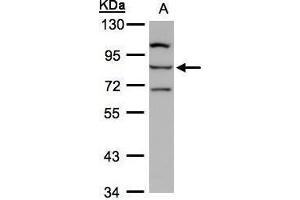 WB Image Sample(30 ug whole cell lysate) A:Hep G2 , 7. (ALOXE3 抗体)