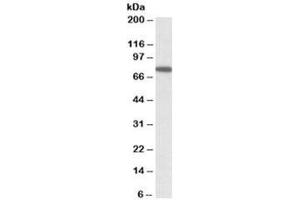 Western blot testing of HeLa lysate with SNX1 antibody at 1ug/ml. (Sorting Nexin 1 抗体)