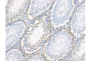 Phospho-PSD95 (Ser418) Antibody at 1/100 staining Rat testis tissue by IHC-P.