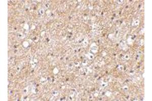 Immunohistochemical staining of human brain tissue using SP110 polyclonal antibody  at 2. (SP110 抗体  (C-Term))