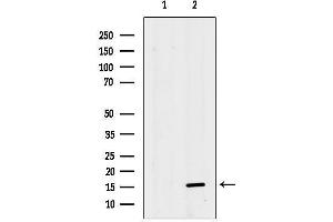 Western blot analysis of lysates from VERO cells, using MRPS36 Antibody.