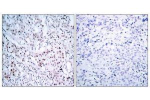 Immunohistochemistry (IHC) image for anti-Jun Proto-Oncogene (JUN) (pSer63) antibody (ABIN1847456) (C-JUN 抗体  (pSer63))