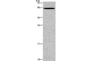 Western blot analysis of Mouse testis tissue, using CATSPER3 Polyclonal Antibody at dilution of 1:350 (CATSPER3 抗体)