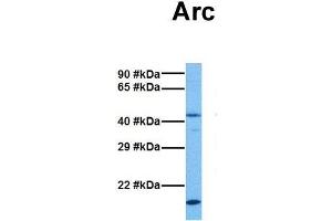 Host:  Rabbit  Target Name:  Arc  Sample Tissue:  Mouse Brain  Antibody Dilution:  1. (ARC (Middle Region) 抗体)