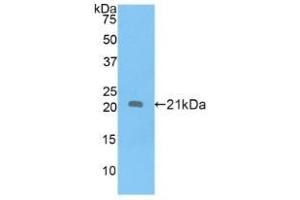 Detection of Recombinant APOD, Human using Polyclonal Antibody to Apolipoprotein D (APOD) (Apolipoprotein D 抗体  (AA 21-189))