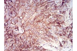 Immunohistochemistry (IHC) image for anti-serpin Peptidase Inhibitor, Clade A (Alpha-1 Antiproteinase, Antitrypsin), Member 1 (SERPINA1) (AA 23-237) antibody (ABIN5542585)